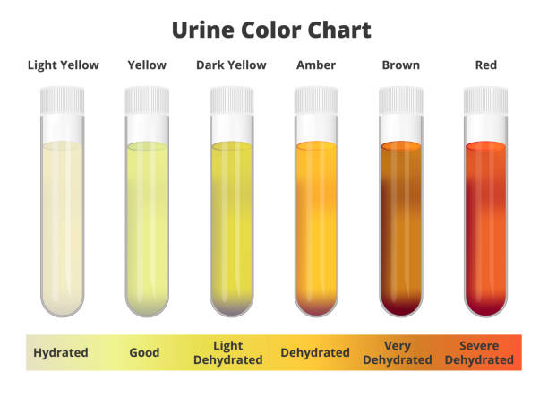 urine colour